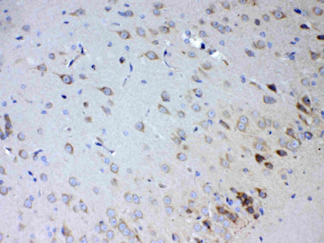 IL15RA Antibody in Immunohistochemistry (Paraffin) (IHC (P))