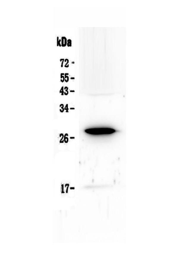 IL15RA Antibody in Western Blot (WB)