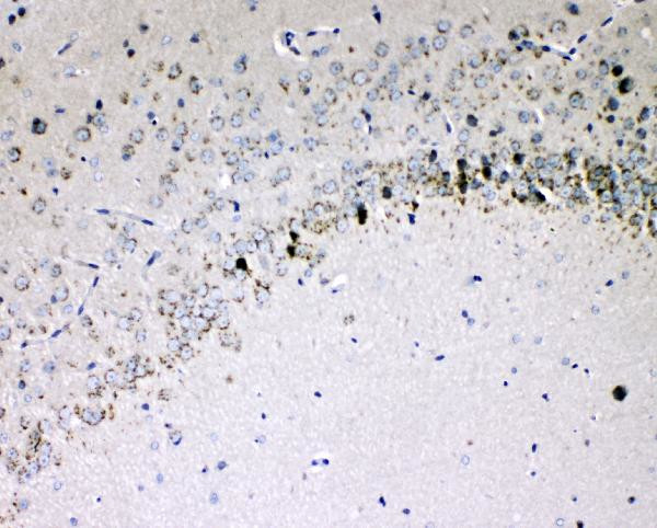 IL-16 Antibody in Immunohistochemistry (Paraffin) (IHC (P))