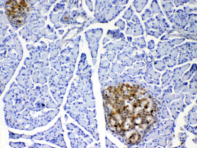 IL-17A Antibody in Immunohistochemistry (Paraffin) (IHC (P))