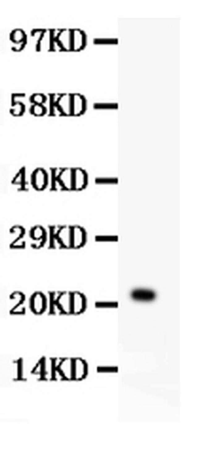 IL-18 Antibody in Western Blot (WB)