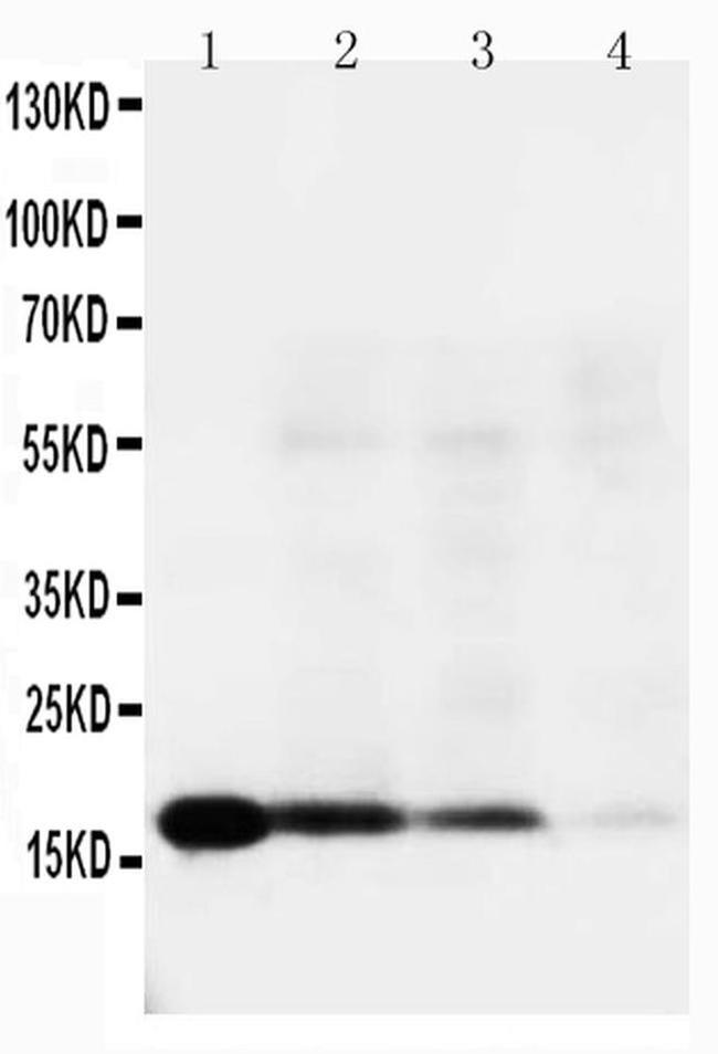IL-18 Antibody in Western Blot (WB)