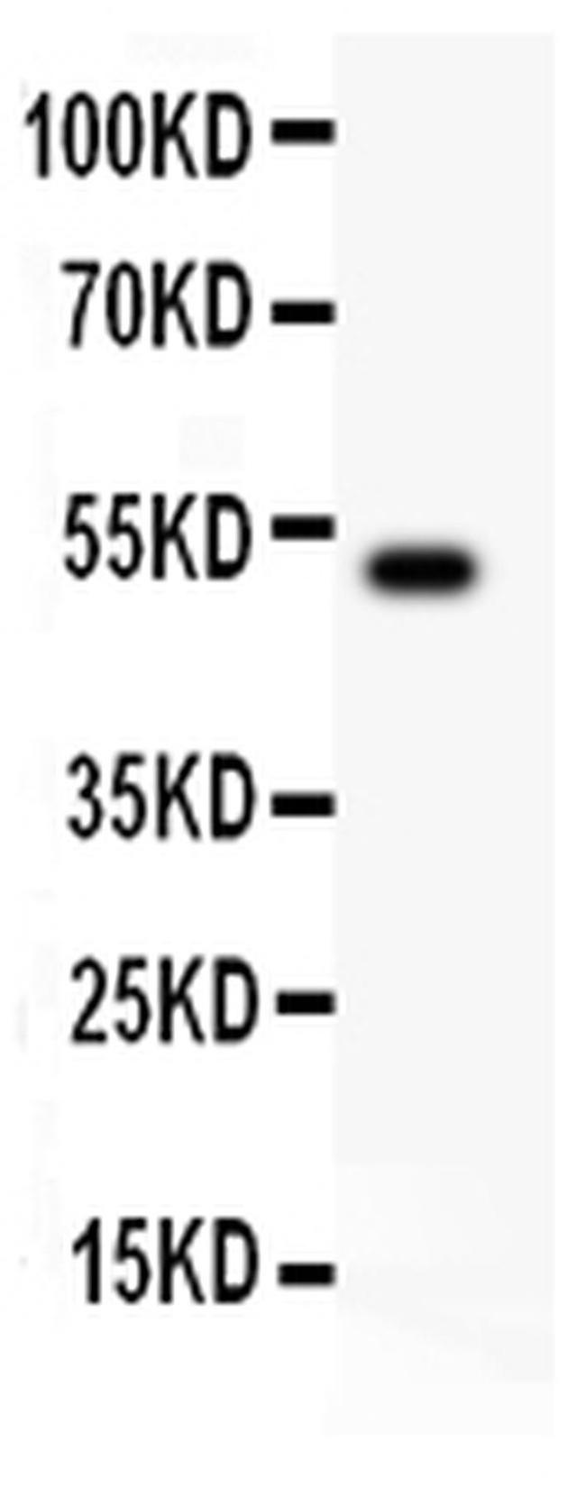 IL-18 Antibody in Western Blot (WB)