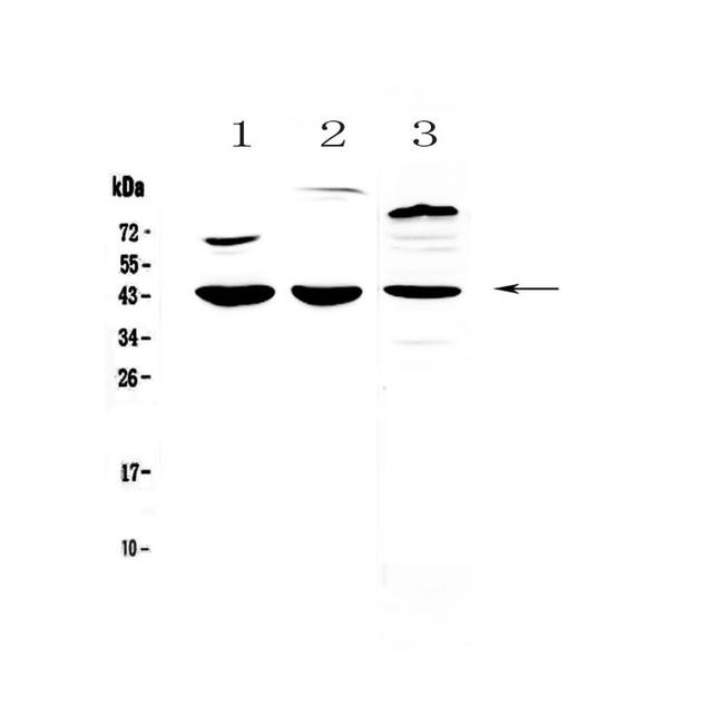 IL18BP Antibody in Western Blot (WB)