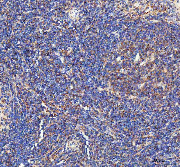 IL-1 beta Antibody in Immunohistochemistry (Paraffin) (IHC (P))