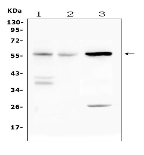 IL23R Antibody in Western Blot (WB)