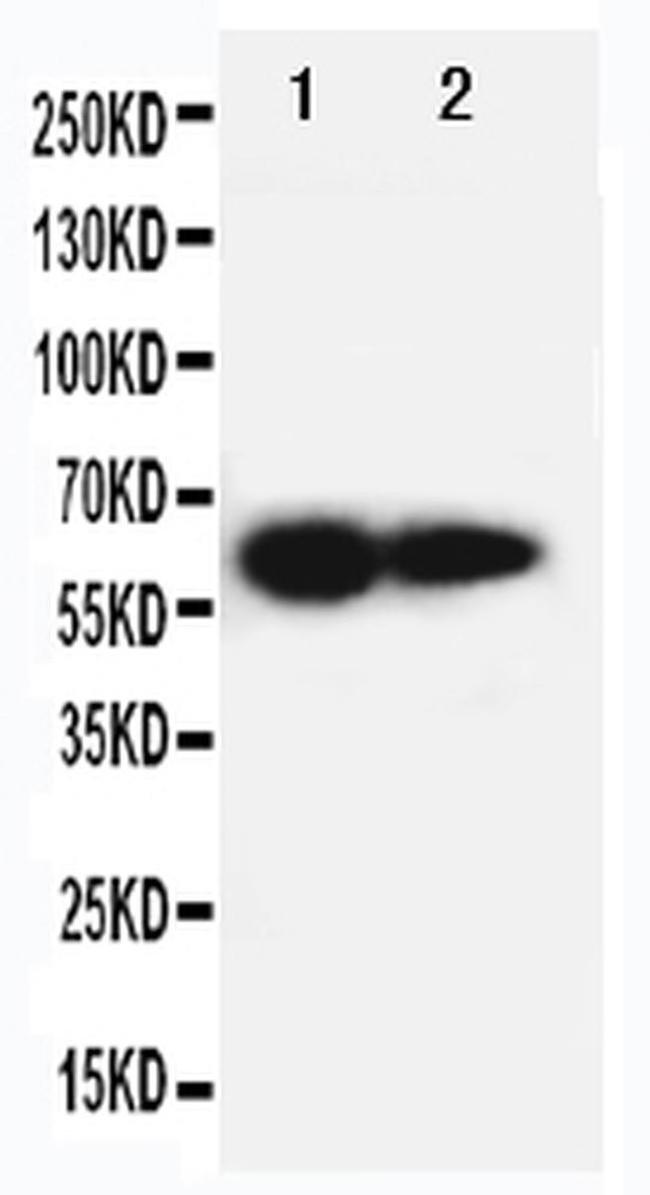CD122 Antibody in Western Blot (WB)