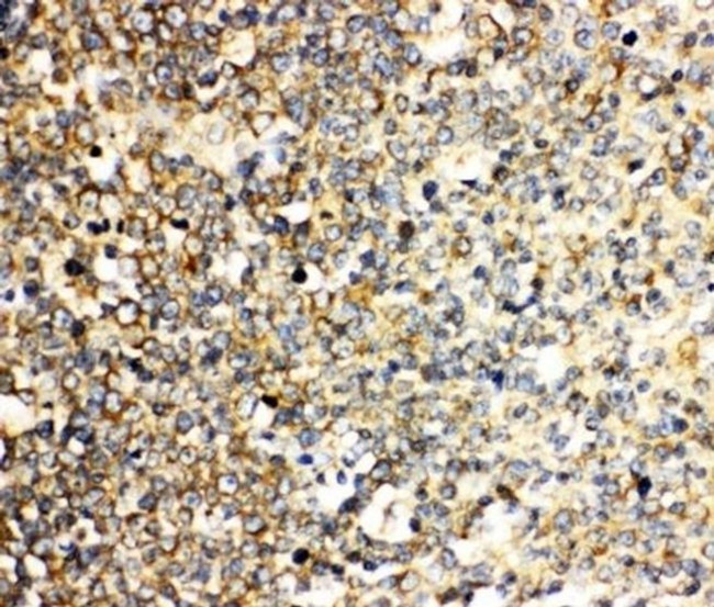 IL-3 Antibody in Immunohistochemistry (Paraffin) (IHC (P))