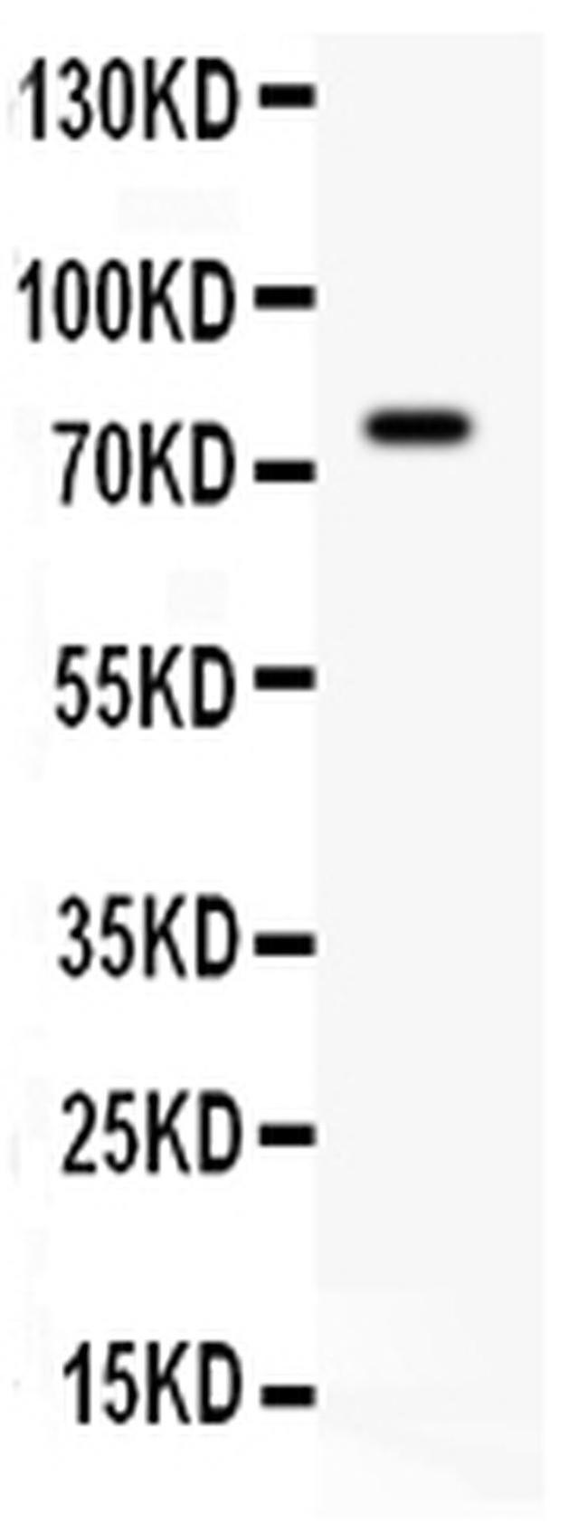 IL-7 Antibody in Western Blot (WB)