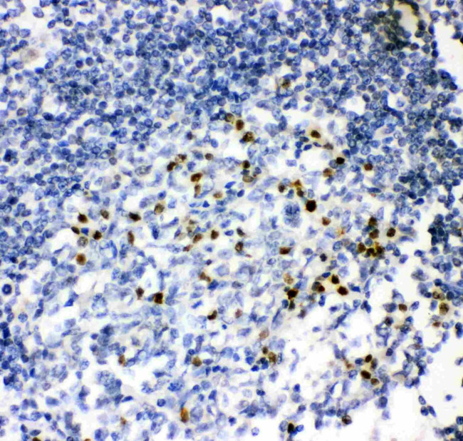 IRF4 Antibody in Immunohistochemistry (Paraffin) (IHC (P))