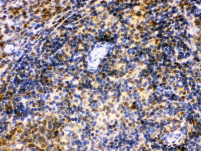 IRF5 Antibody in Immunohistochemistry (Paraffin) (IHC (P))