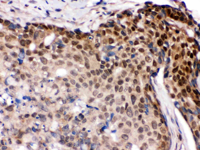 IRF5 Antibody in Immunohistochemistry (Paraffin) (IHC (P))