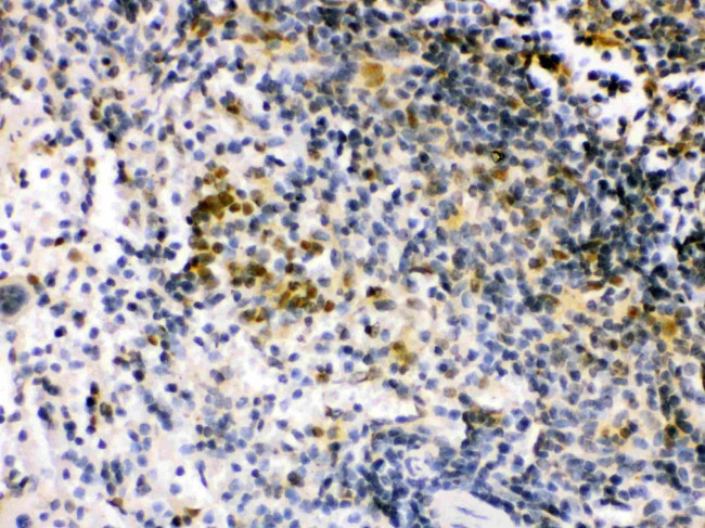 IRF5 Antibody in Immunohistochemistry (Paraffin) (IHC (P))