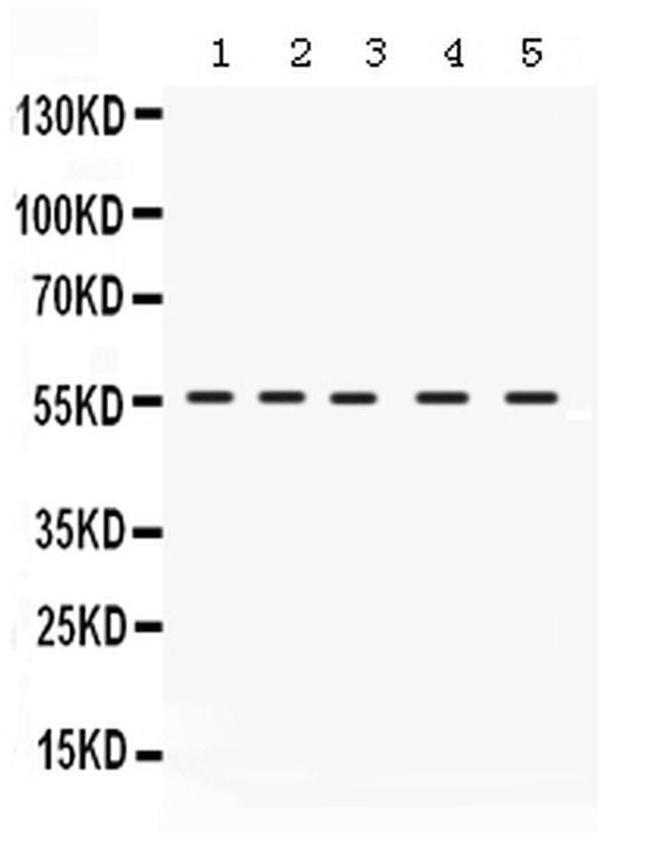 IRF5 Antibody in Western Blot (WB)