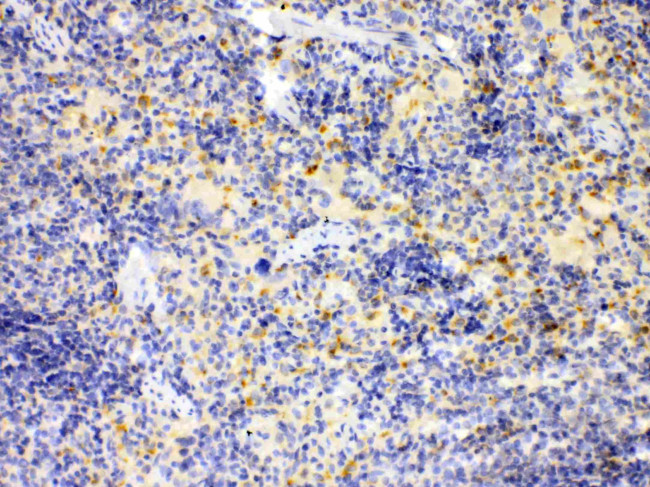 IRF7 Antibody in Immunohistochemistry (Paraffin) (IHC (P))