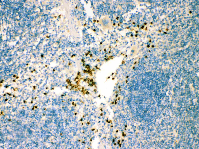 IRF7 Antibody in Immunohistochemistry (Paraffin) (IHC (P))