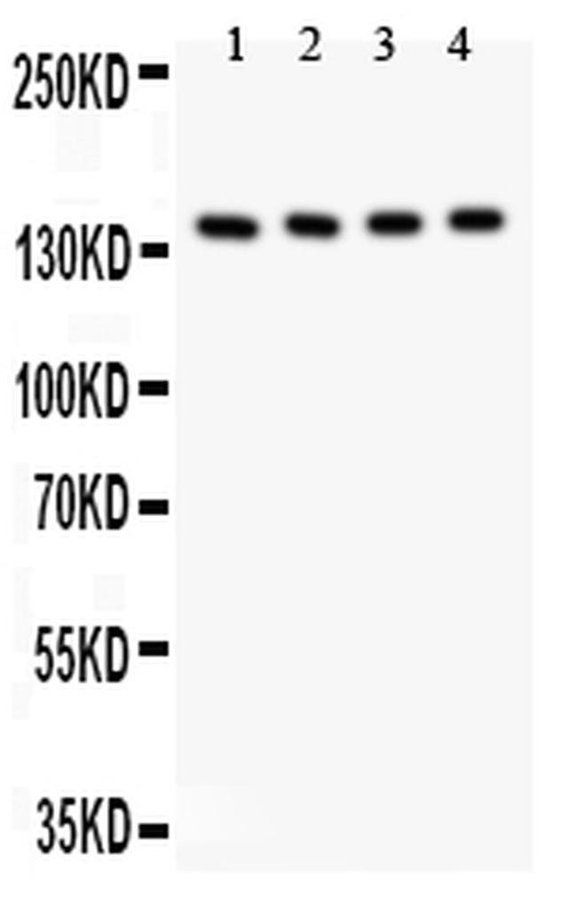 IRS2 Antibody in Western Blot (WB)