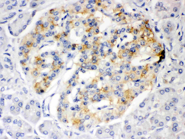 ISG15 Antibody in Immunohistochemistry (Paraffin) (IHC (P))