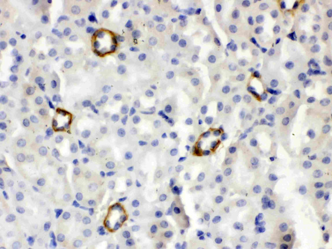 ISG15 Antibody in Immunohistochemistry (Paraffin) (IHC (P))