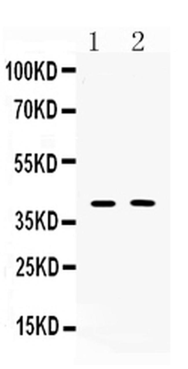 ISL1 Antibody in Western Blot (WB)