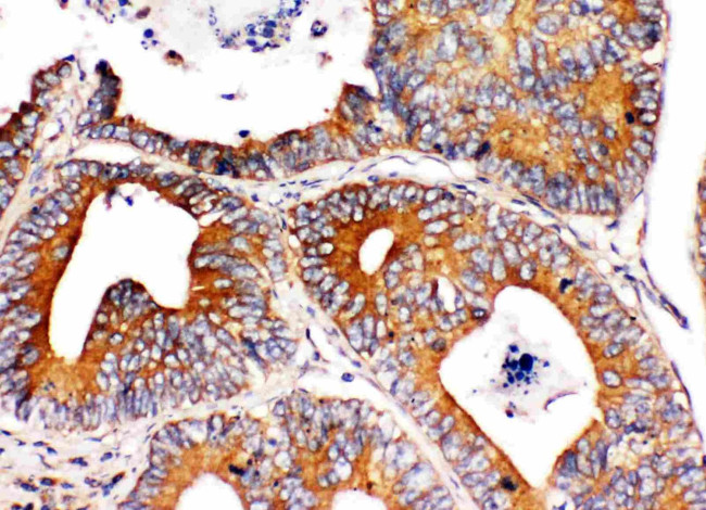 CD49a (Integrin alpha 1) Antibody in Immunohistochemistry (Paraffin) (IHC (P))