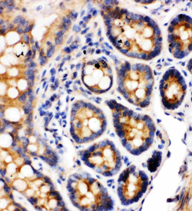 CD49a (Integrin alpha 1) Antibody in Immunohistochemistry (Paraffin) (IHC (P))