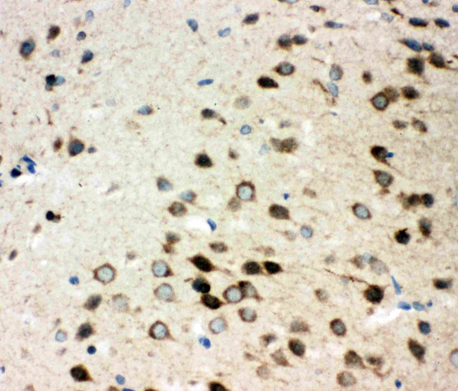 CD49c (Integrin alpha 3) Antibody in Immunohistochemistry (Paraffin) (IHC (P))