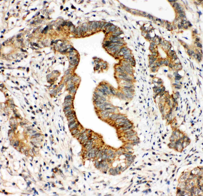 CD49c (Integrin alpha 3) Antibody in Immunohistochemistry (Paraffin) (IHC (P))