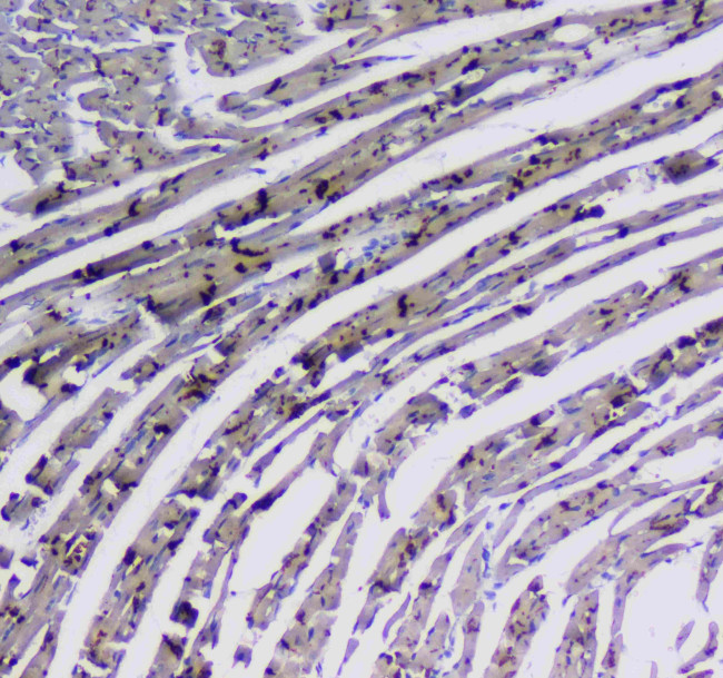 CD49e (Integrin alpha 5) Antibody in Immunohistochemistry (Paraffin) (IHC (P))