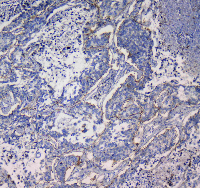 CD49e (Integrin alpha 5) Antibody in Immunohistochemistry (Paraffin) (IHC (P))