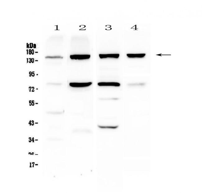 CD49e (Integrin alpha 5) Antibody in Western Blot (WB)