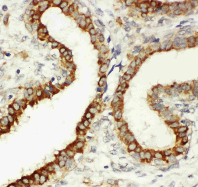 CD61 (Integrin beta 3) Antibody in Immunohistochemistry (Paraffin) (IHC (P))