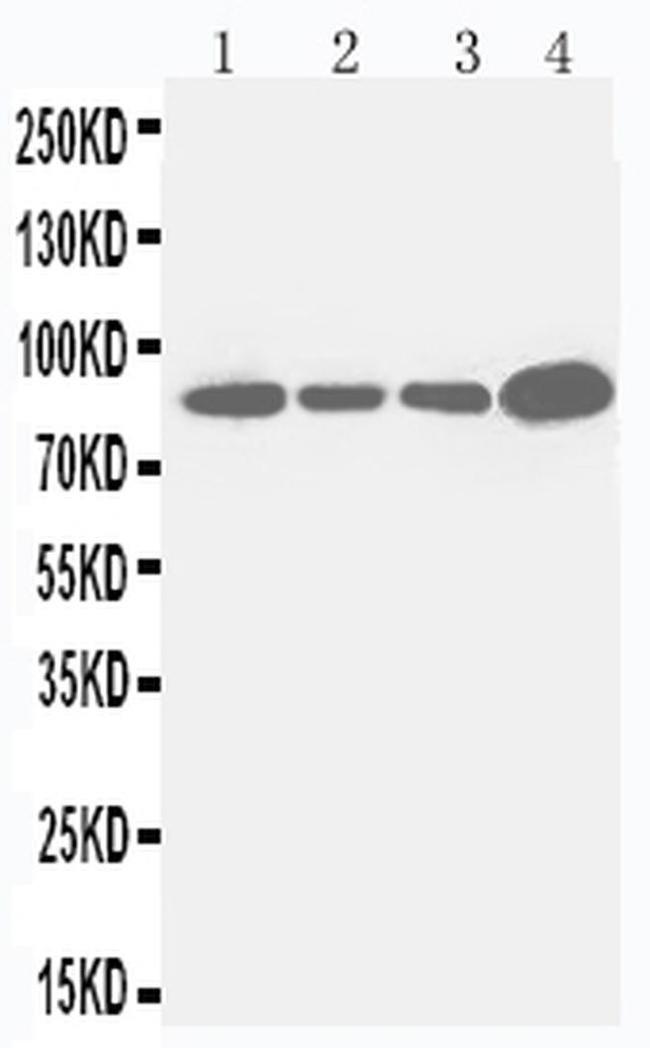 CD61 (Integrin beta 3) Antibody in Western Blot (WB)