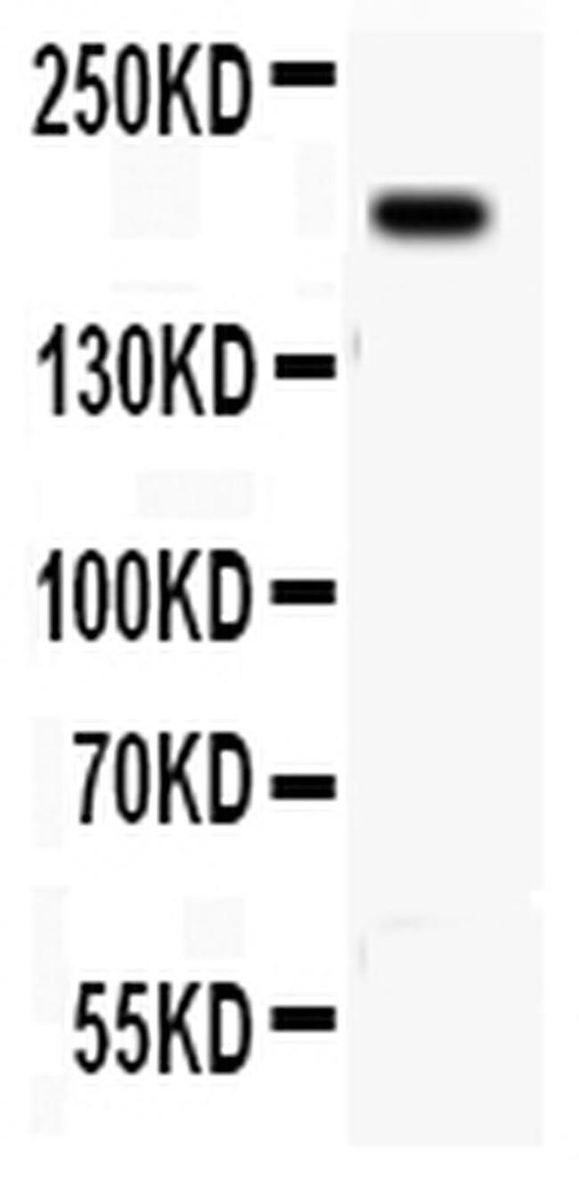 CD104 (Integrin beta 4) Antibody in Western Blot (WB)