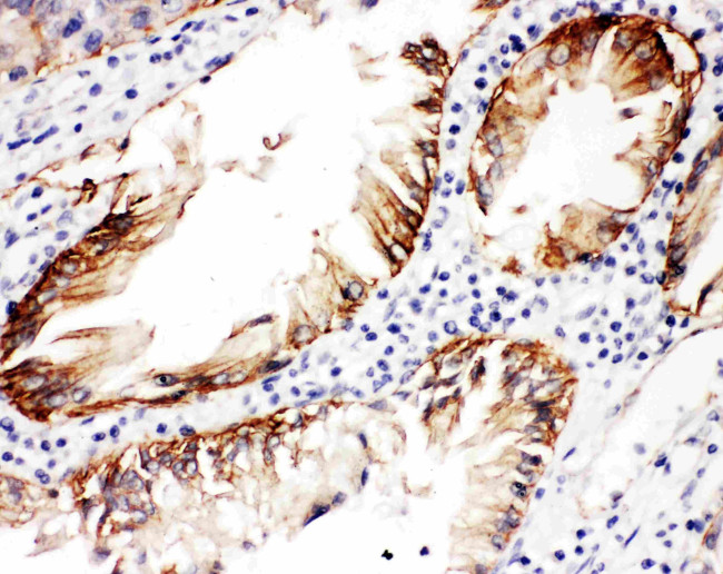 CD104 (Integrin beta 4) Antibody in Immunohistochemistry (Paraffin) (IHC (P))