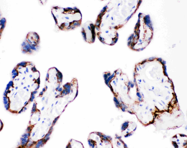 CD104 (Integrin beta 4) Antibody in Immunohistochemistry (Paraffin) (IHC (P))