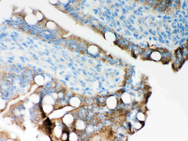 ITPR3 Antibody in Immunohistochemistry (Paraffin) (IHC (P))