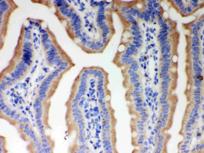 ITPR3 Antibody in Immunohistochemistry (Paraffin) (IHC (P))