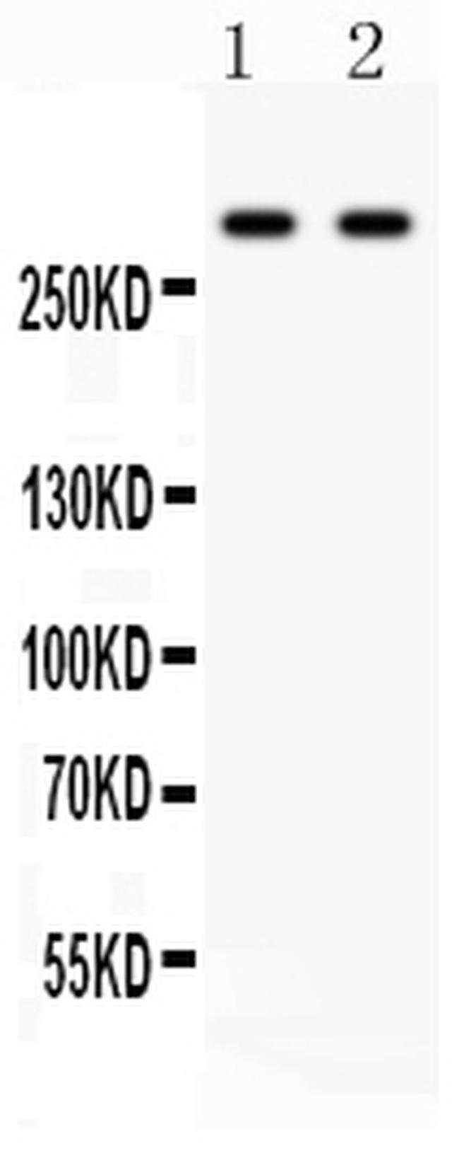 ITPR3 Antibody in Western Blot (WB)