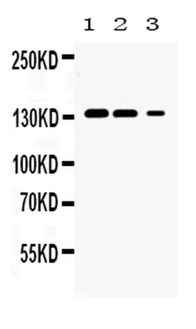 JAK1 Antibody in Western Blot (WB)