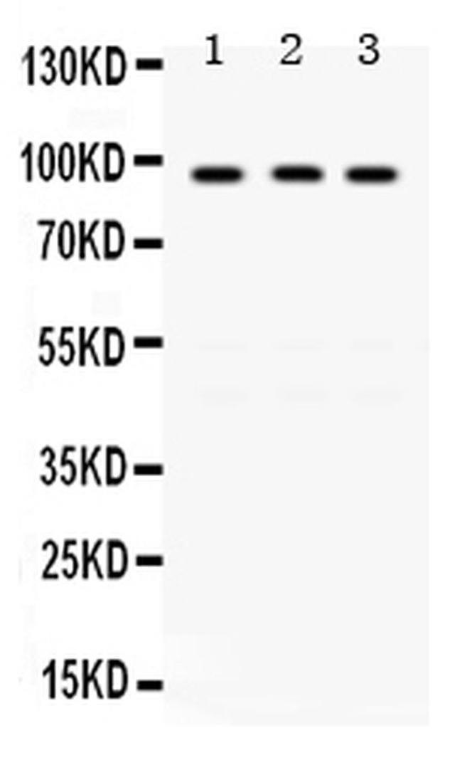 GCN5 Antibody in Western Blot (WB)