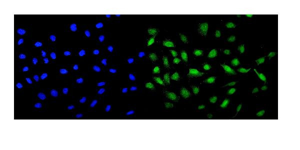 MCAK Antibody in Immunocytochemistry (ICC/IF)