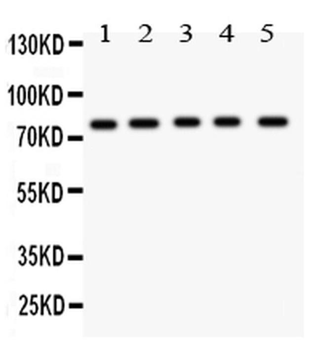 MCAK Antibody in Western Blot (WB)