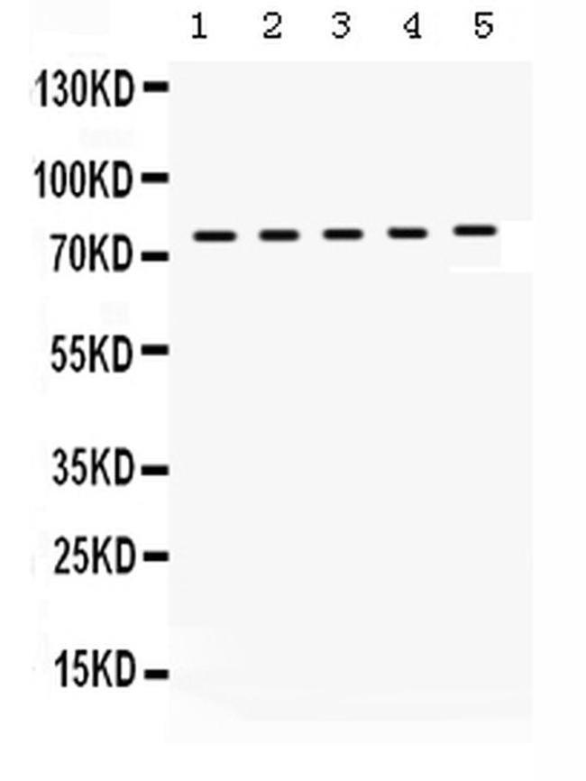 KIF3A Antibody in Western Blot (WB)