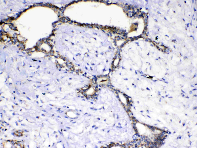 SCF Antibody in Immunohistochemistry (Paraffin) (IHC (P))