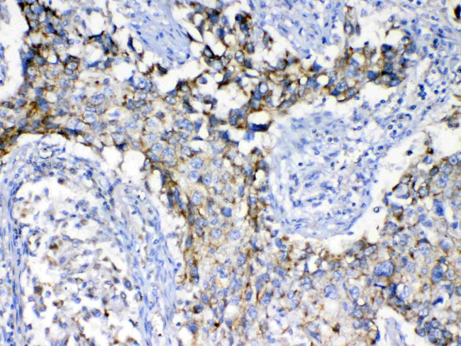 SCF Antibody in Immunohistochemistry (Paraffin) (IHC (P))