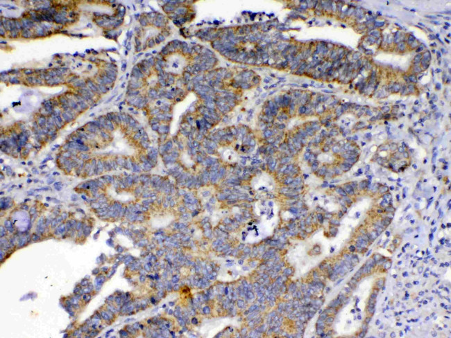 SCF Antibody in Immunohistochemistry (Paraffin) (IHC (P))