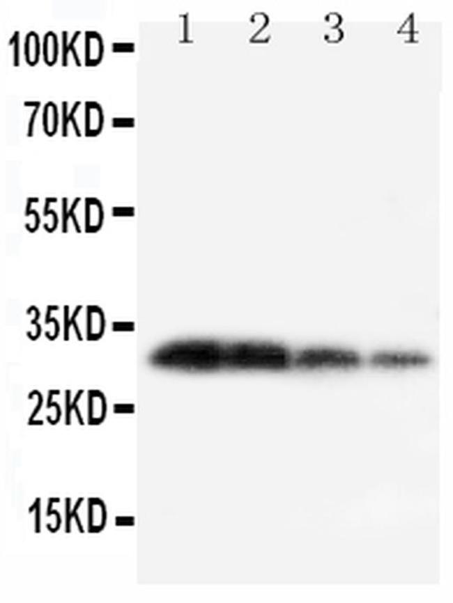 Kallikrein 1 Antibody in Western Blot (WB)