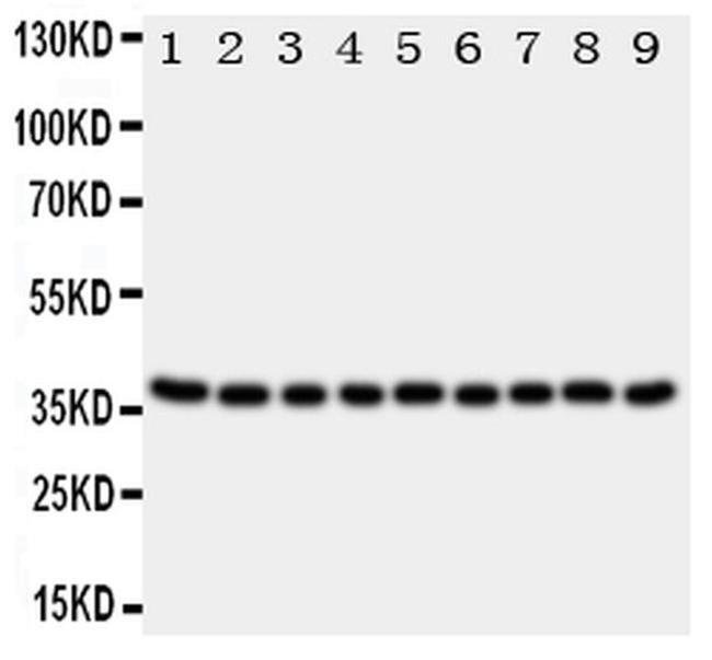 Kallikrein 10 Antibody in Western Blot (WB)