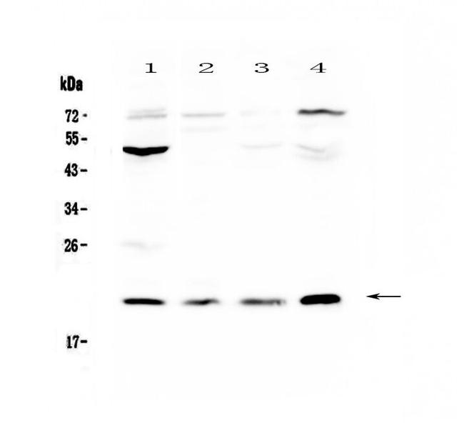 Kallikrein 2 Antibody in Western Blot (WB)